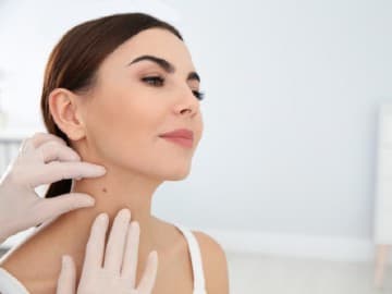 Lady having a birth mark on her neck checked by a dermatologist